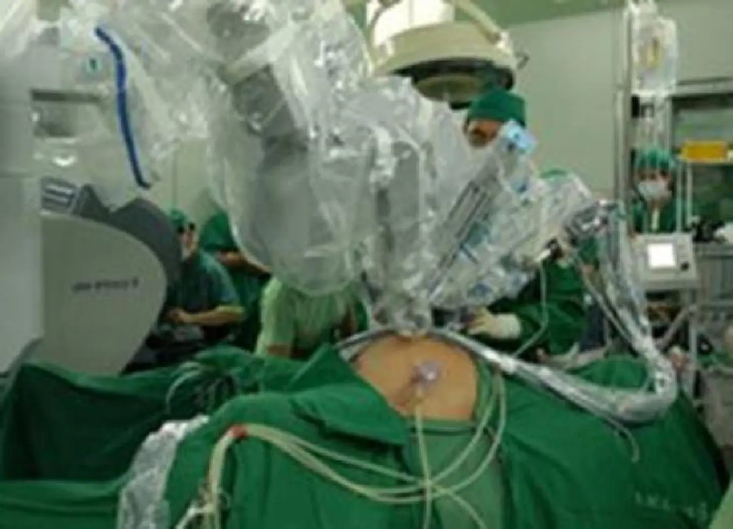 Siriraj Hospital is regional pioneer in robotic knee surgery Siriraj Hospital is regional pioneer in robotic knee surgery