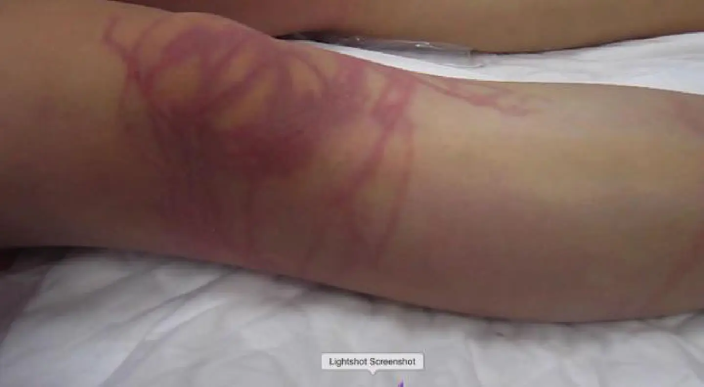 German tourist dies of jellyfish sting German tourist dies of jellyfish sting