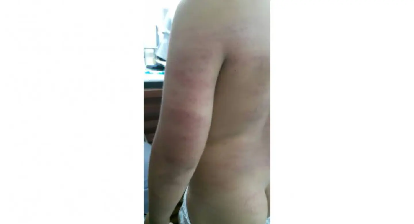 Traumatised boy’s mother demands action on alleged abuse by teacher Traumatised boy’s mother demands action on alleged abuse by teacher