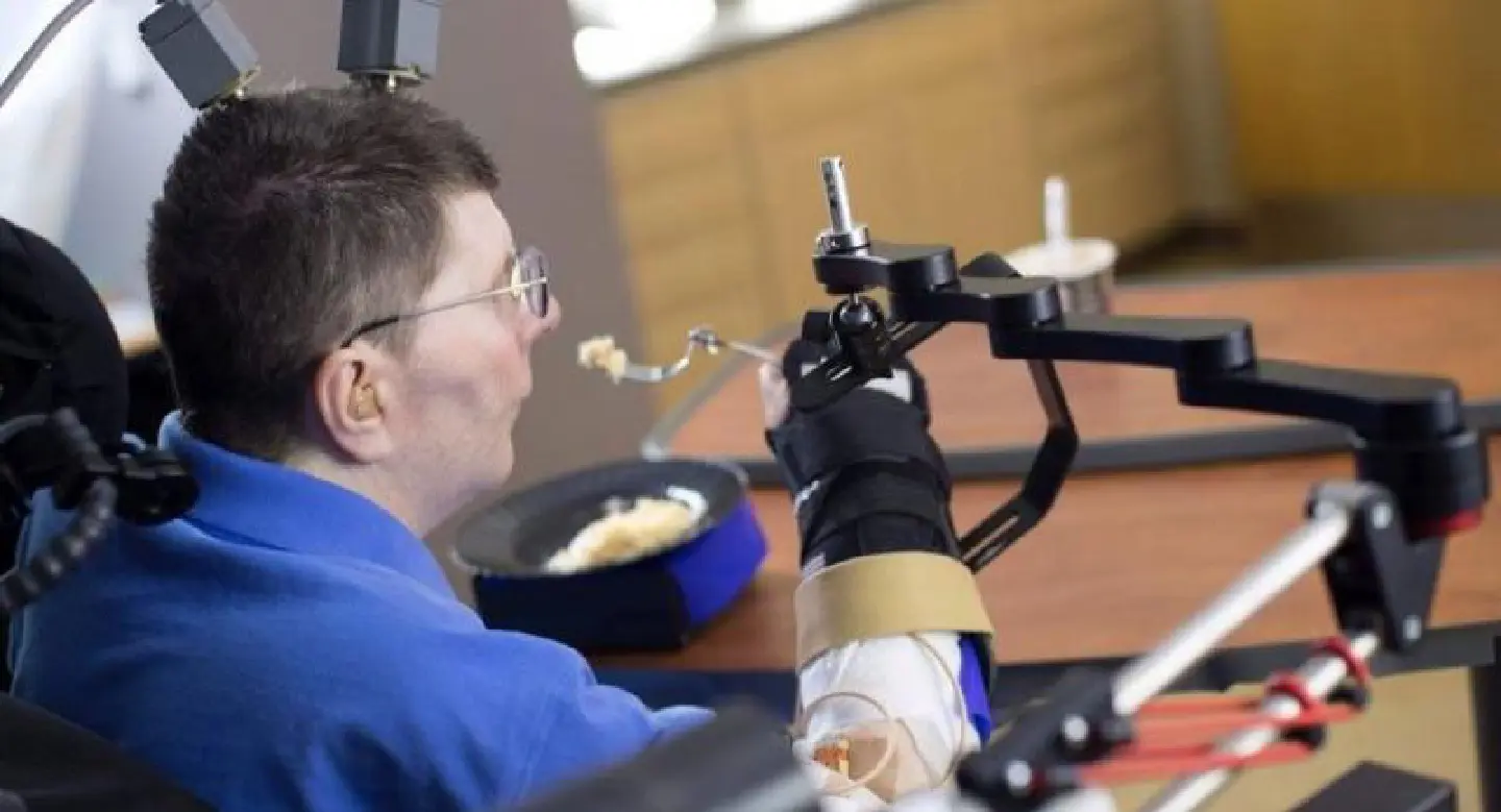 Quadriplegic man regains use of arm in medical first: study