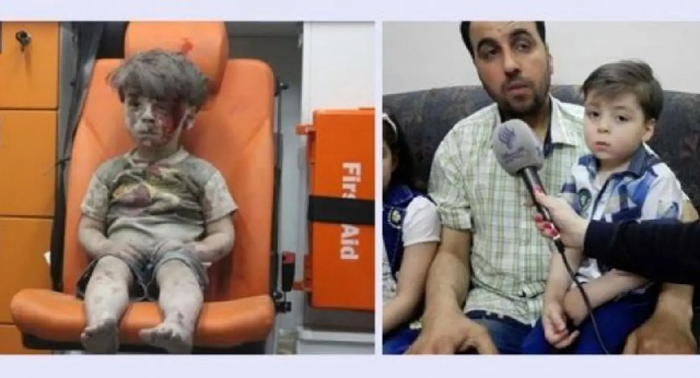 New photo of "Aleppo Boy" of Syria New photo of "Aleppo Boy" of Syria