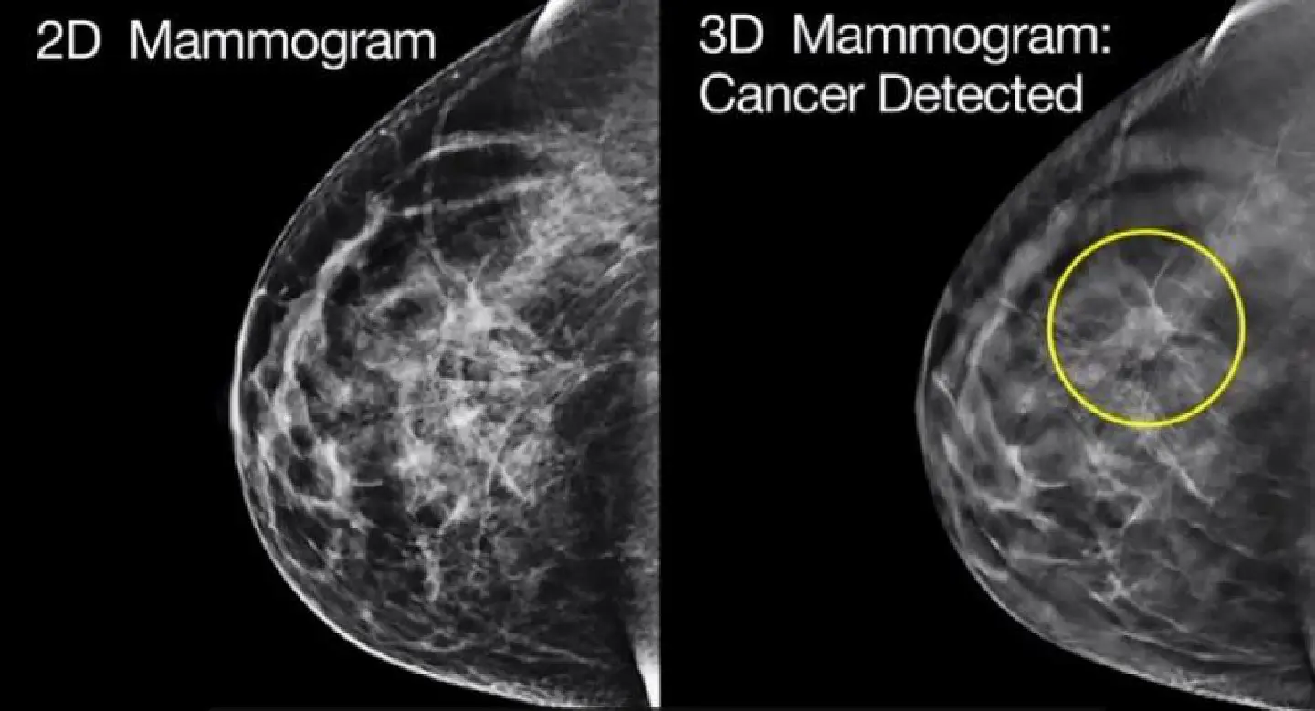 Cancer in the blood Cancer in the blood