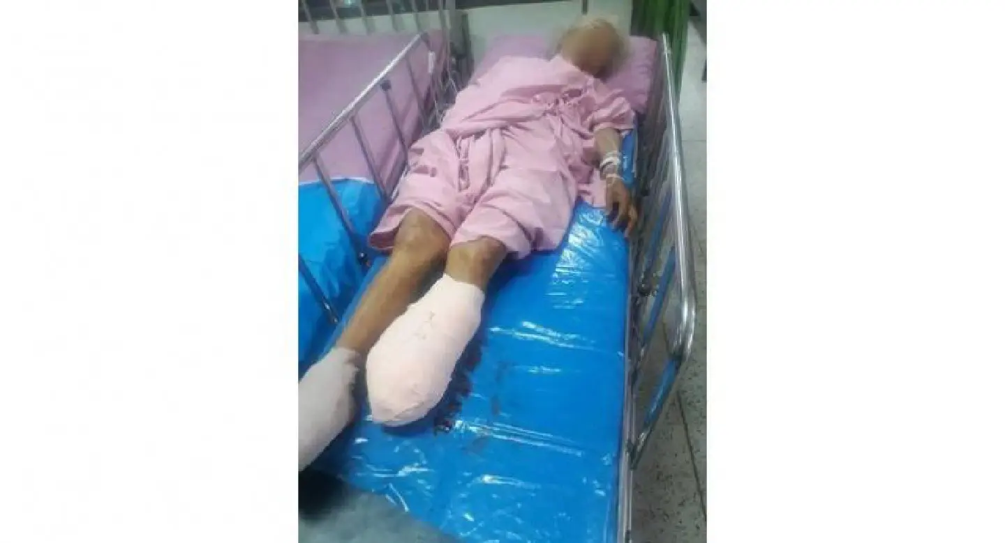 Donations pour in for elderly woman injured in train mishap