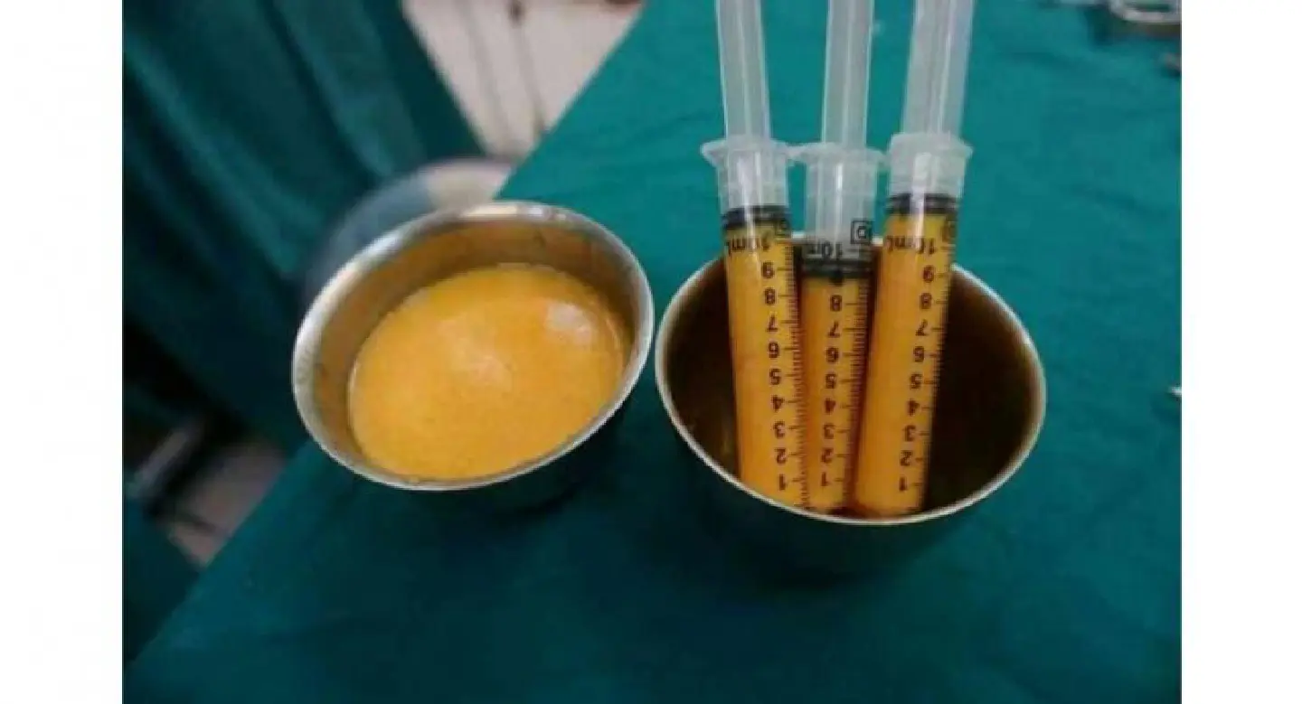 Hospital reprimanded for female genital Hospital reprimanded for female genital