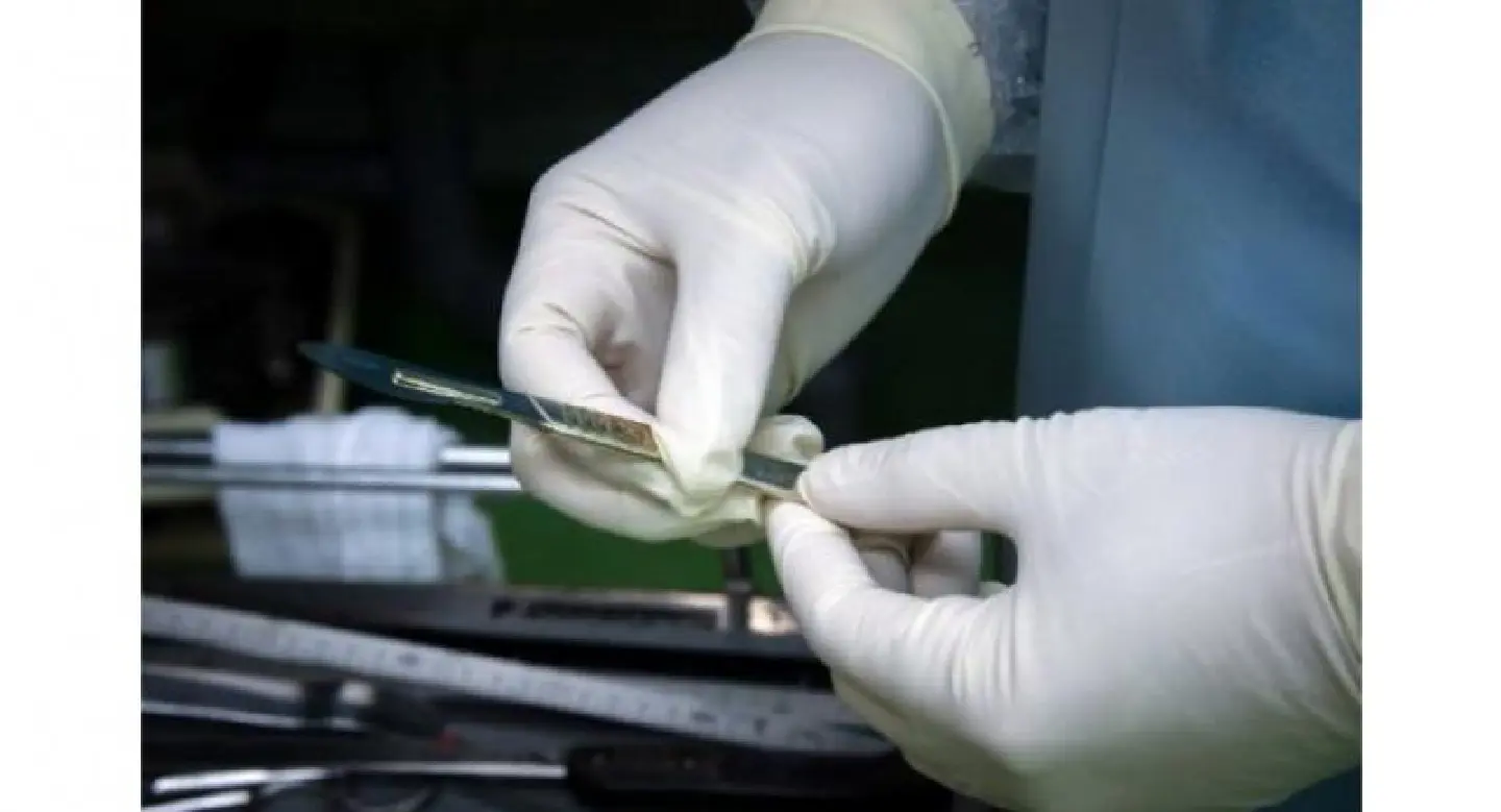 Surgeon writes his initials on patients’ liver during transplants Surgeon writes his initials on patients’ liver during transplants