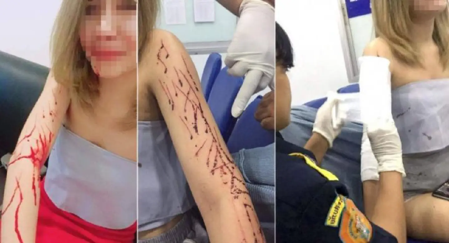 Woman robbed, injured by Bangkok taxi driver