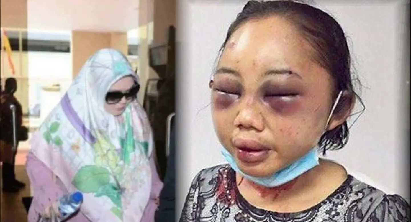 Over 40,000 sign petition against sentence for Datin who abused maid