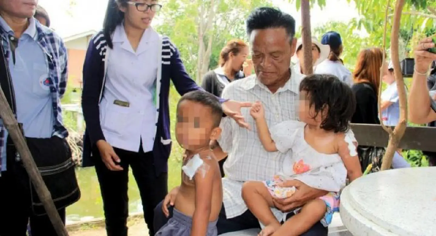 Children at risk of rabies– despite vaccinations – after savage attack by dog