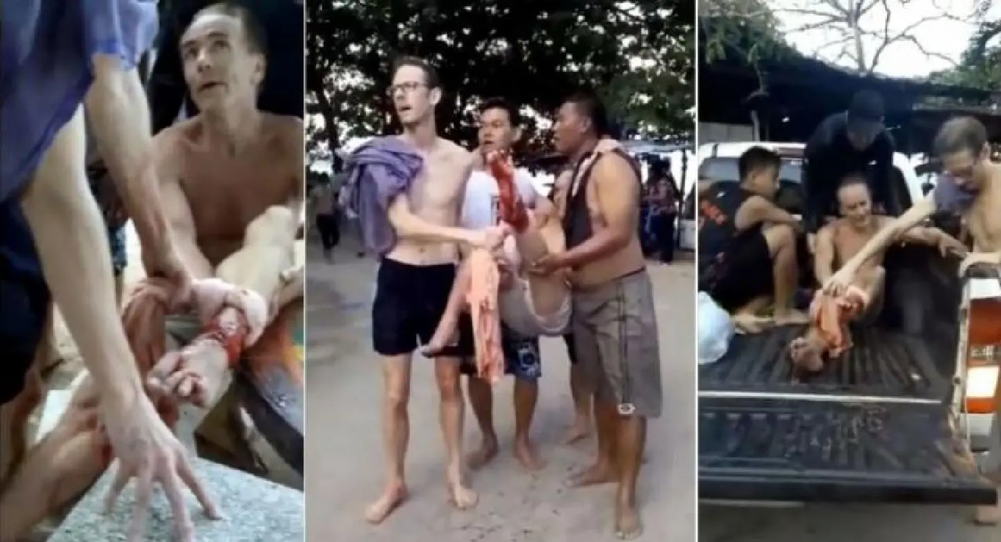 Officers probe ‘shark attack’ today as mayor issues warning to tourists