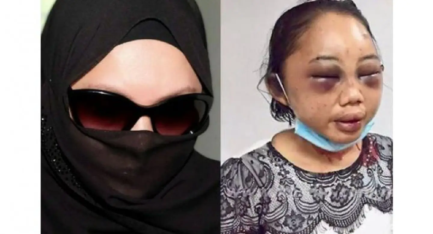‘Datin’ who assaulted maid out on bail pending appeal of increased sentence