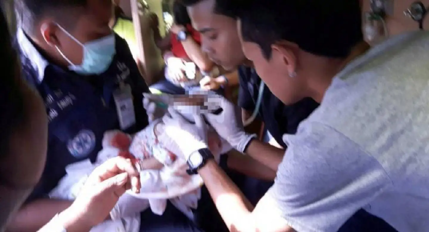 Rabies confirmed after infant dog attack Rabies confirmed after infant dog attack