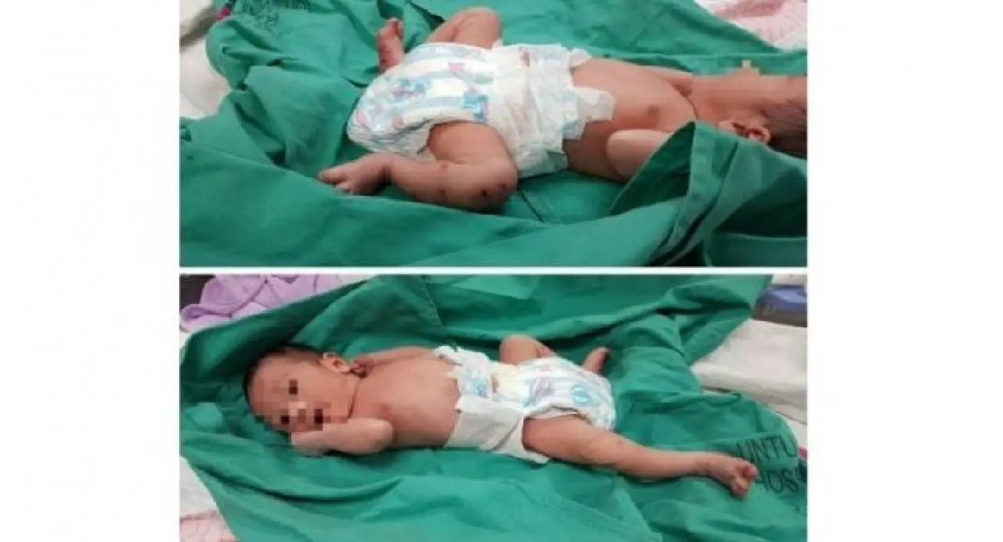 Baby boy abandoned, found with dog bites in Malaysia Baby boy abandoned, found with dog bites in Malaysia