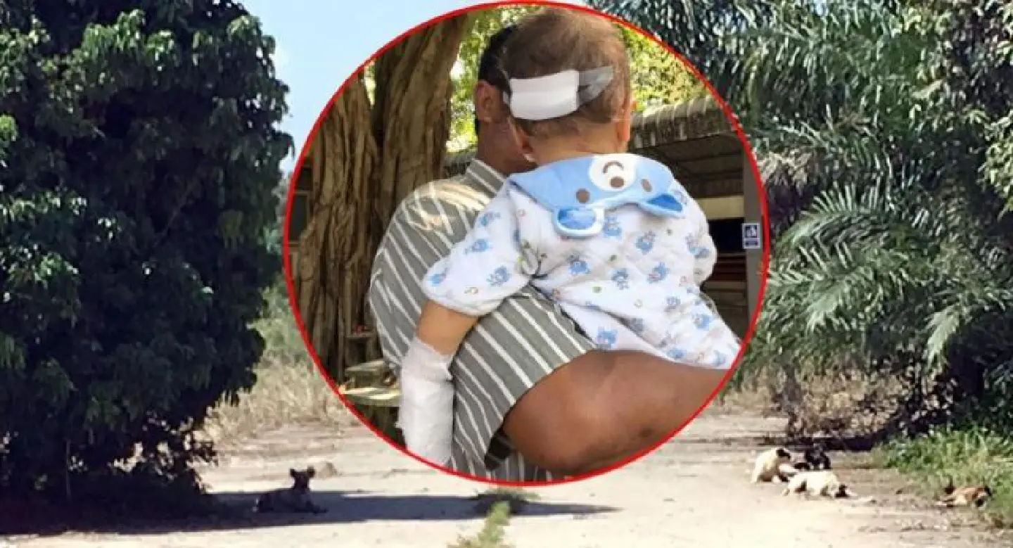 Attack on child prompts action against strays Attack on child prompts action against strays