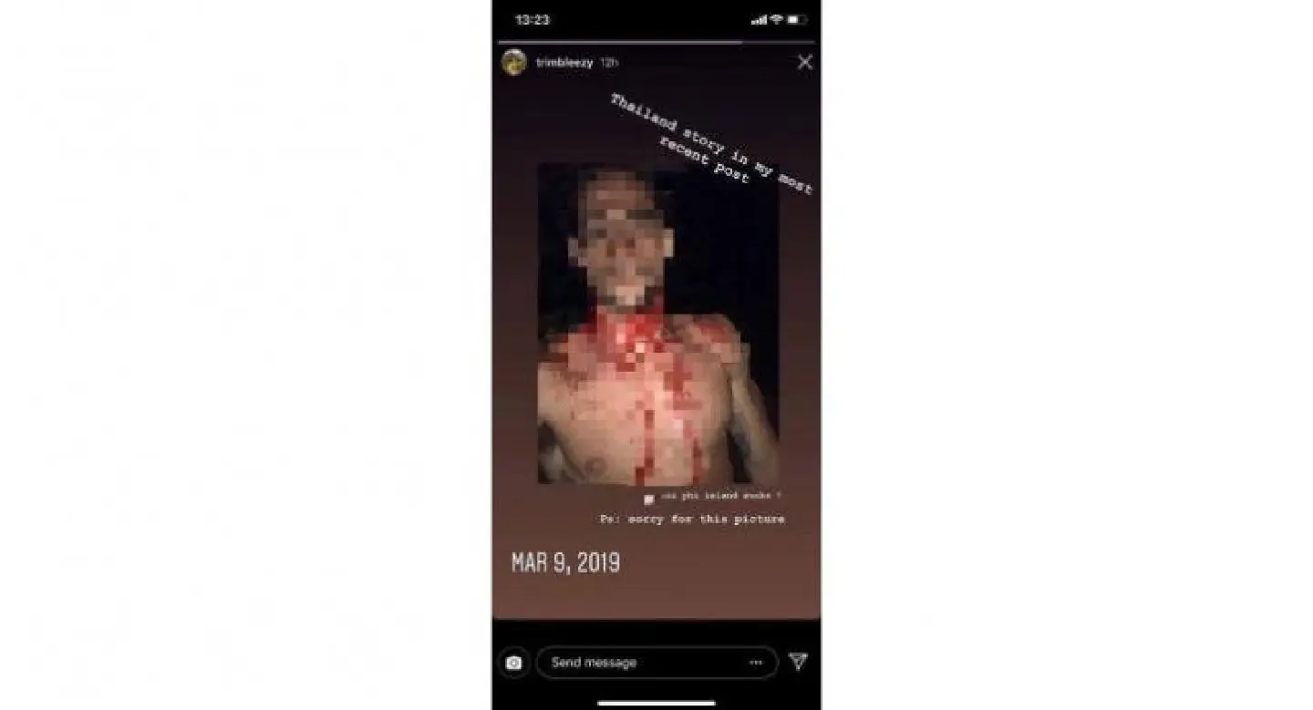 US tourist attacked by gang after stopping Phi Phi robbery US tourist attacked by gang after stopping Phi Phi robbery