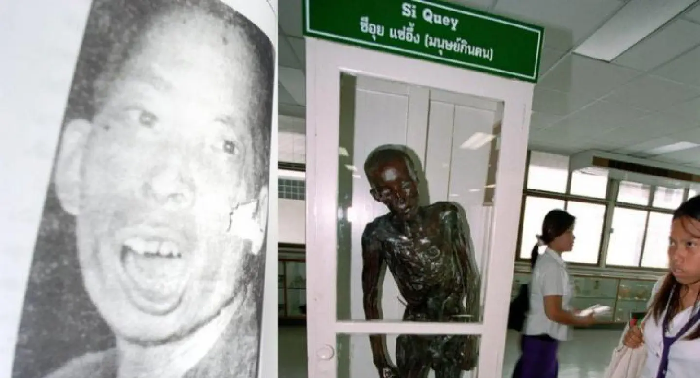 Hospital removes 'cannibal' sign from Si Quey corpse display Hospital removes 'cannibal' sign from Si Quey corpse display