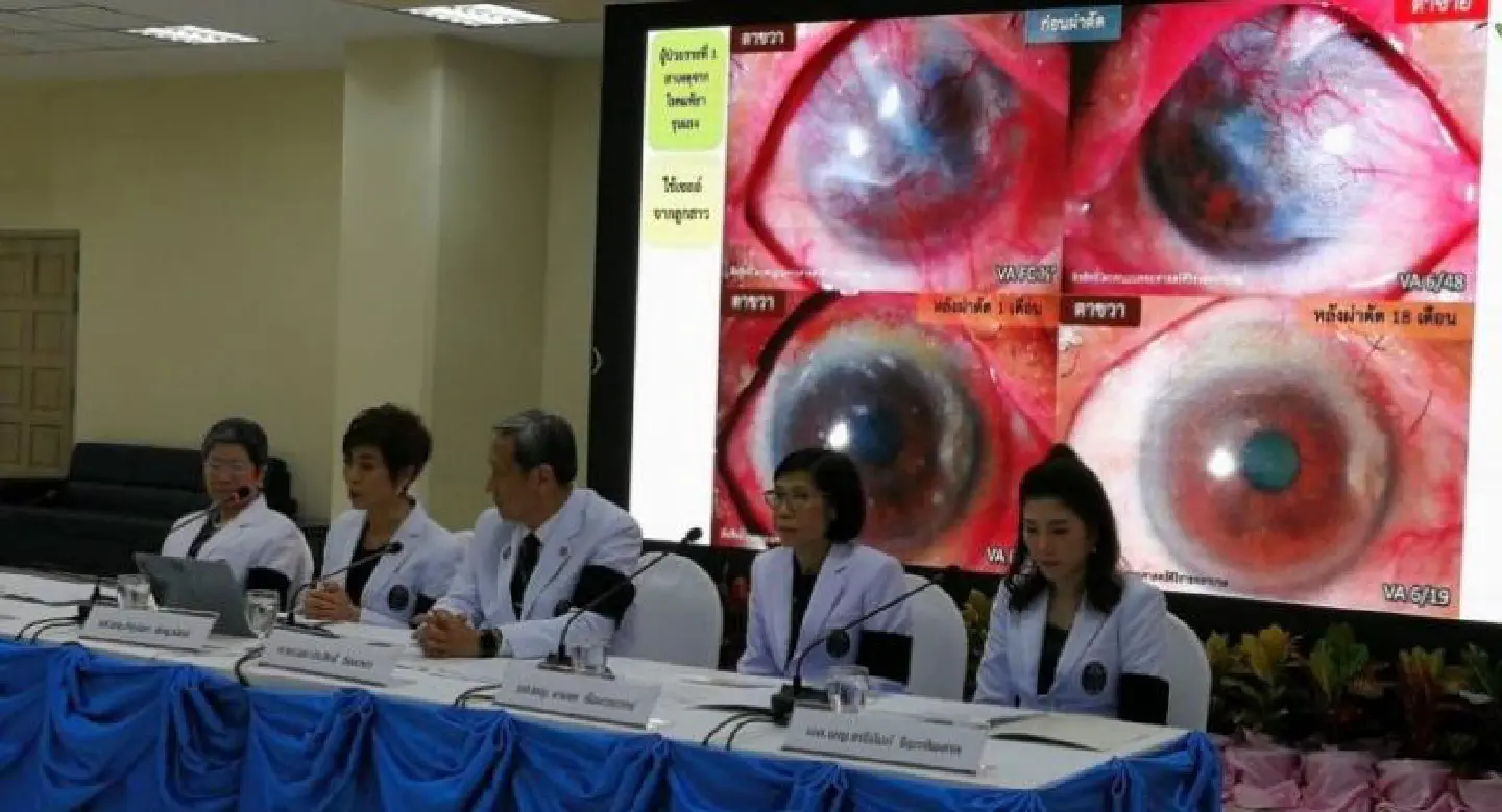 Siriraj successful in ground-breaking stemcell treatment