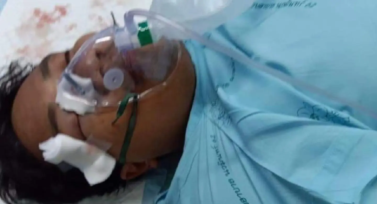 ‘Ja New’ needs eye socket operation, say human rights lawyers ‘Ja New’ needs eye socket operation, say human rights lawyers