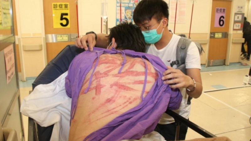 HK pro-democracy protesters beaten by white-shirted men armed with sticks HK pro-democracy protesters beaten by white-shirted men armed with sticks