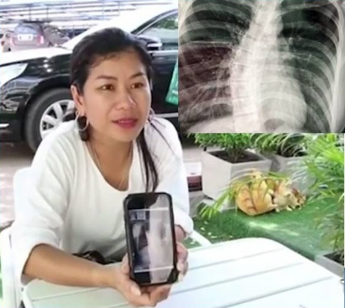 Heavy schoolbags not direct cause of scoliosis, says MD Heavy schoolbags not direct cause of scoliosis, says MD
