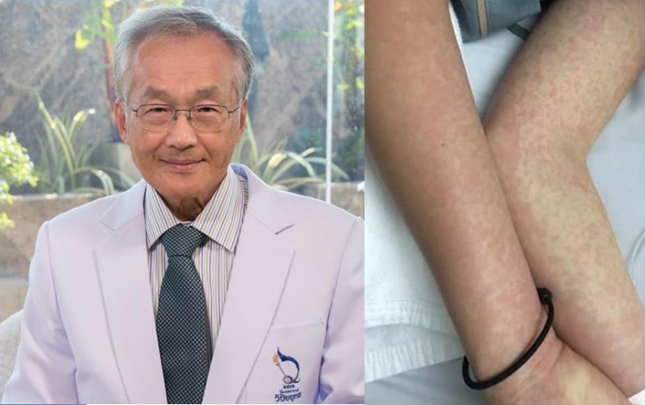 Chikungunya virus has mutated offering greater risk, warns doctor Chikungunya virus has mutated offering greater risk, warns doctor