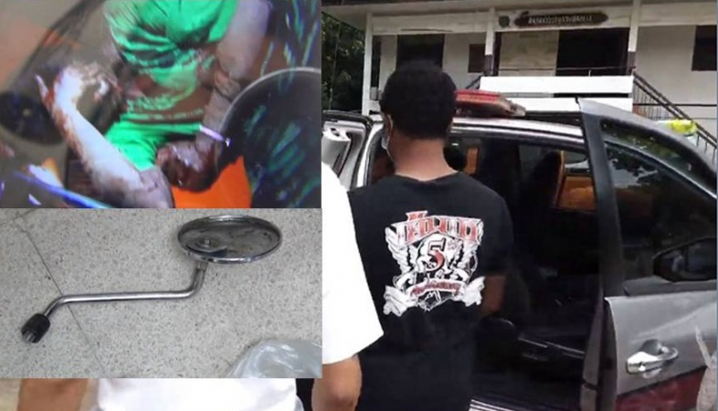 Police detain man for assaulting, setting his girlfriend on fire Police detain man for assaulting, setting his girlfriend on fire