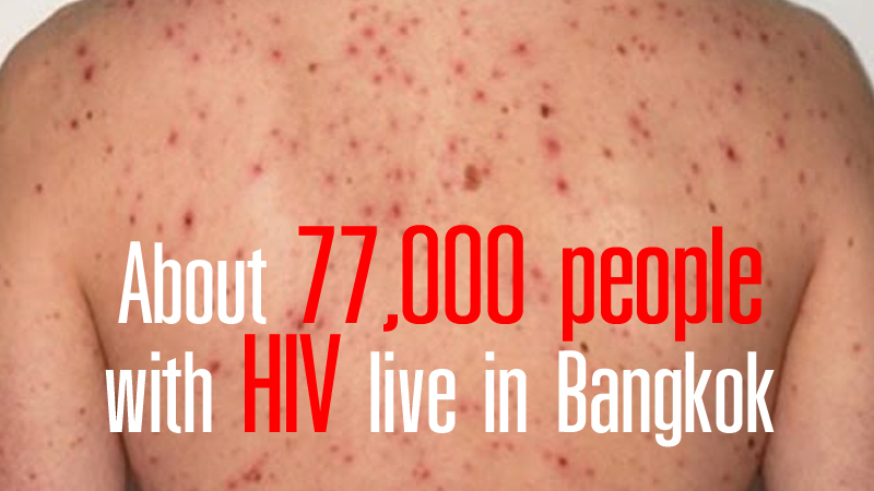 About 77,000 people with HIV live in Bangkok About 77,000 people with HIV live in Bangkok