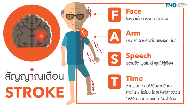 Stroke care and prevention Stroke care and prevention