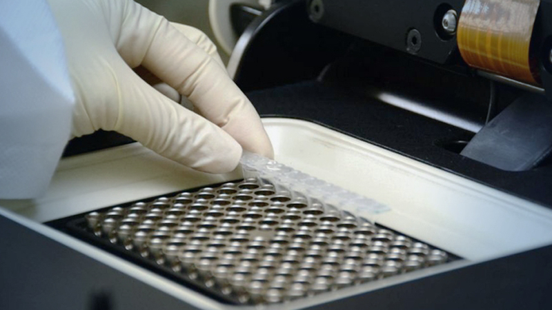 Pre-symptoms virus tests prove nothing, MD says Pre-symptoms virus tests prove nothing, MD says
