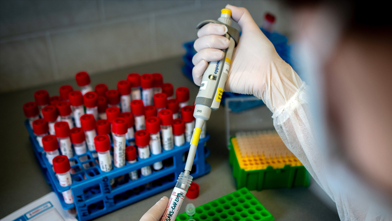 WHO adopts test method that helped stifle Ebola for Coronavirus WHO adopts test method that helped stifle Ebola for Coronavirus