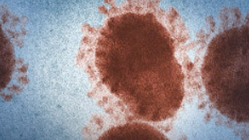 Urban centers nationwide prepare for catastrophic virus outbreak Urban centers nationwide prepare for catastrophic virus outbreak
