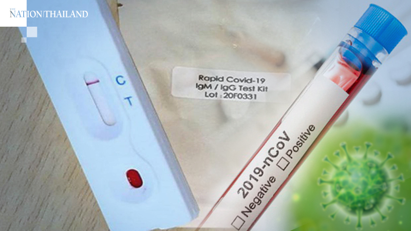 New locally produced Covid-19 test kits to be distributed soon New locally produced Covid-19 test kits to be distributed soon