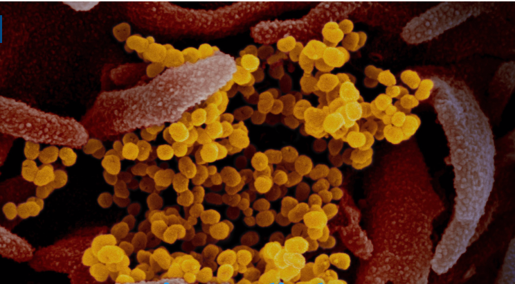 COVID-19 cases in PH climb to 4,648 as 220 more persons get infection COVID-19 cases in PH climb to 4,648 as 220 more persons get infection