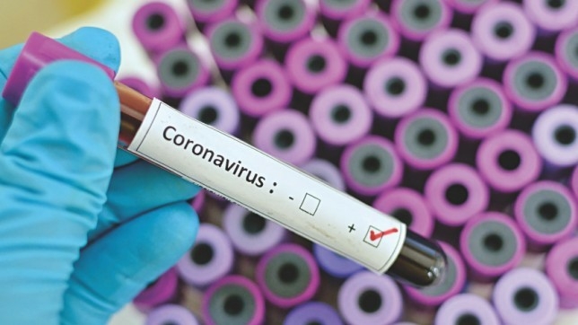 First Covid-19 case detected at Rohingya camp First Covid-19 case detected at Rohingya camp