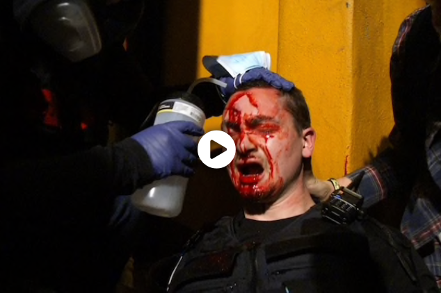 SEATTLE - Protests in several major cities across the country turned violent this weekend, as weeks of civil unrest and clashes between activists and authorities boiled over, sending thousands of people teeming into public squares demanding racial justice.