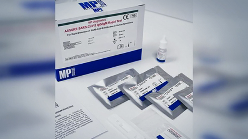 The test kit detects antibodies known as IgG and IgM.PHOTO: MP BIOMEDICALS