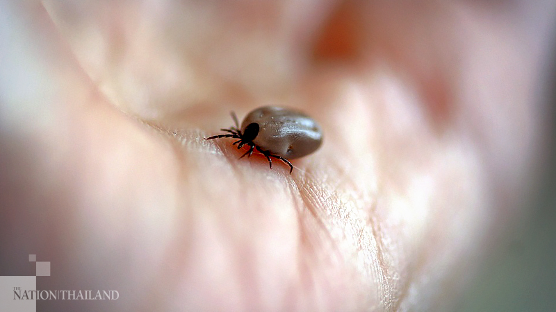 Tick bites can be deadly, doctor warns Tick bites can be deadly, doctor warns