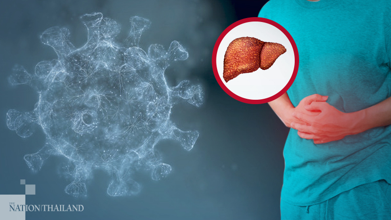 Global survey reveals Covid’s heavy toll on liver cancer care Global survey reveals Covid’s heavy toll on liver cancer care