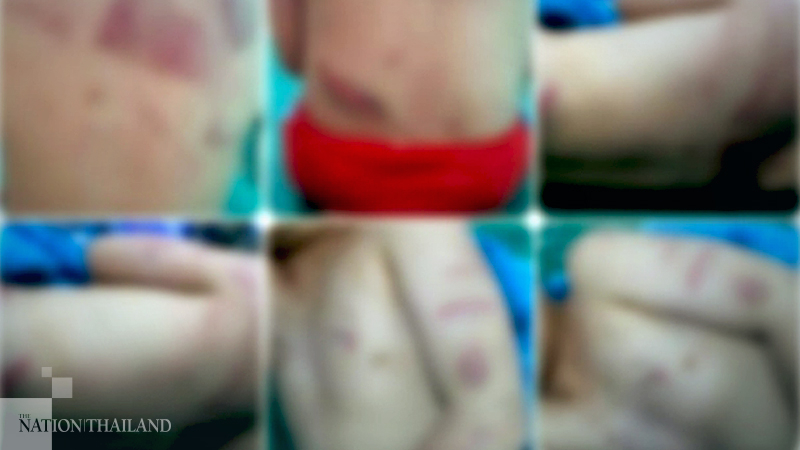 Angry mother faces charges for beating mischievous child Angry mother faces charges for beating mischievous child