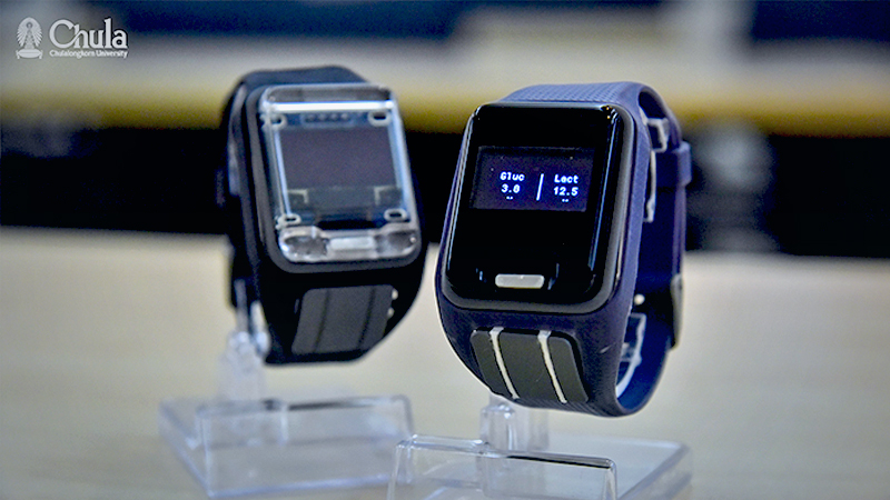Chula develops smartwatch to beat diabetes Chula develops smartwatch to beat diabetes