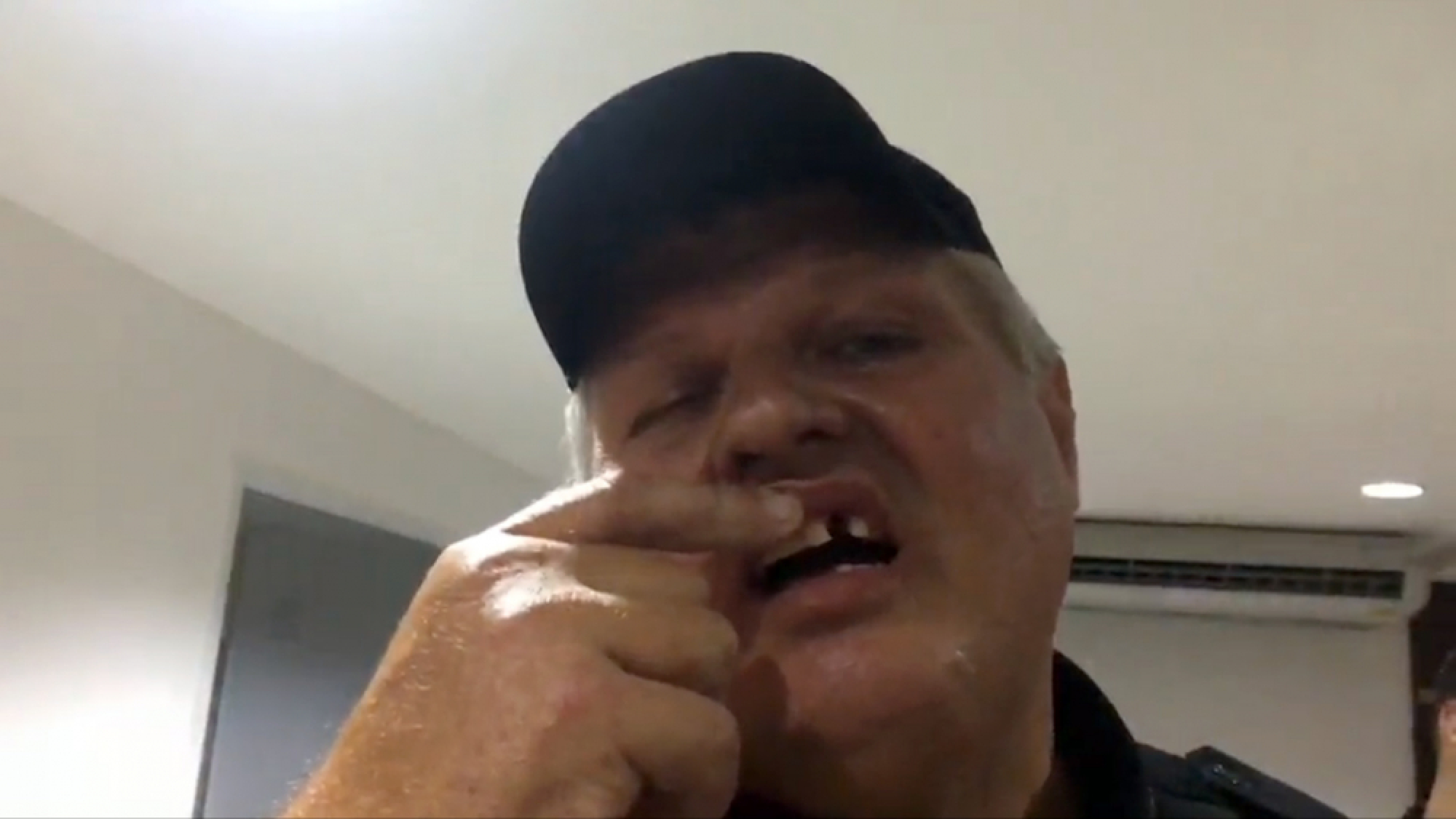 Russian volunteer loses tooth from punch by drunk tourist in Pattaya