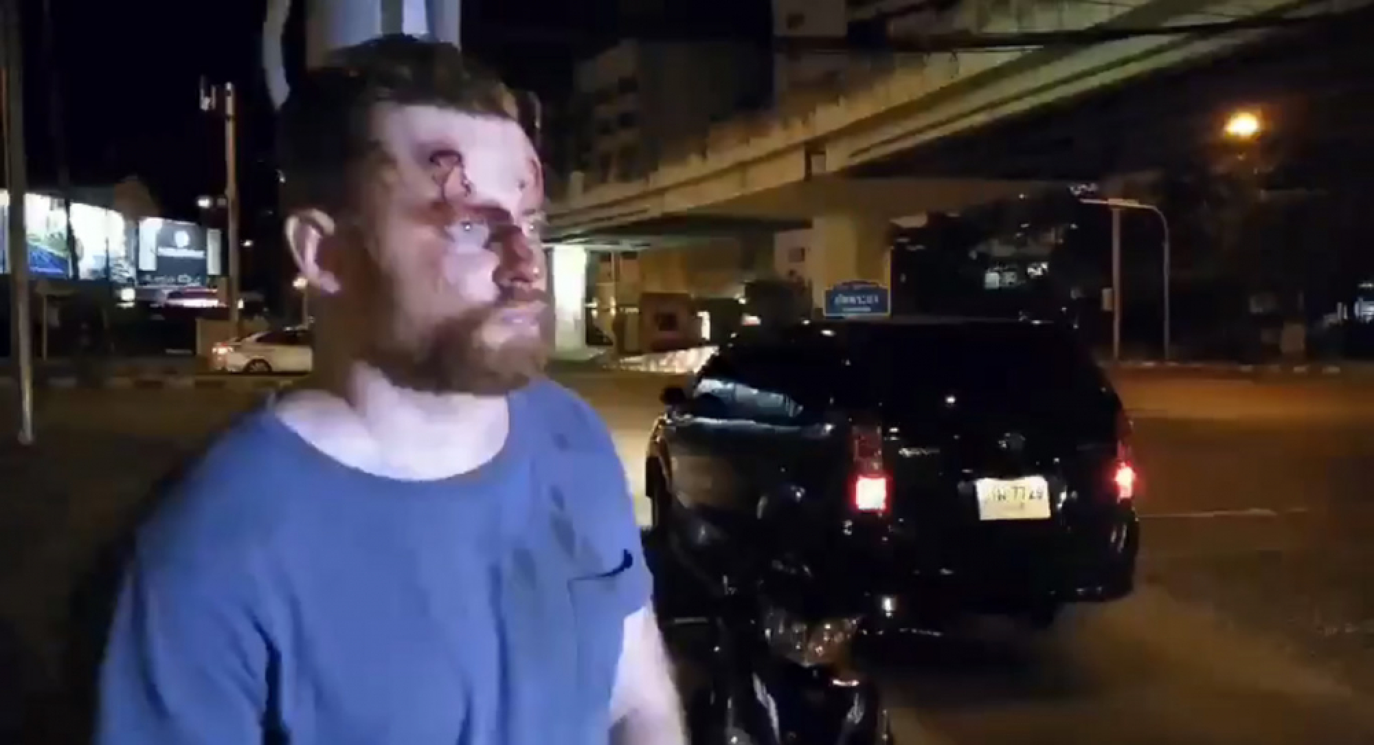 Wounded foreigner helped, taken to hospital after being injured in fight