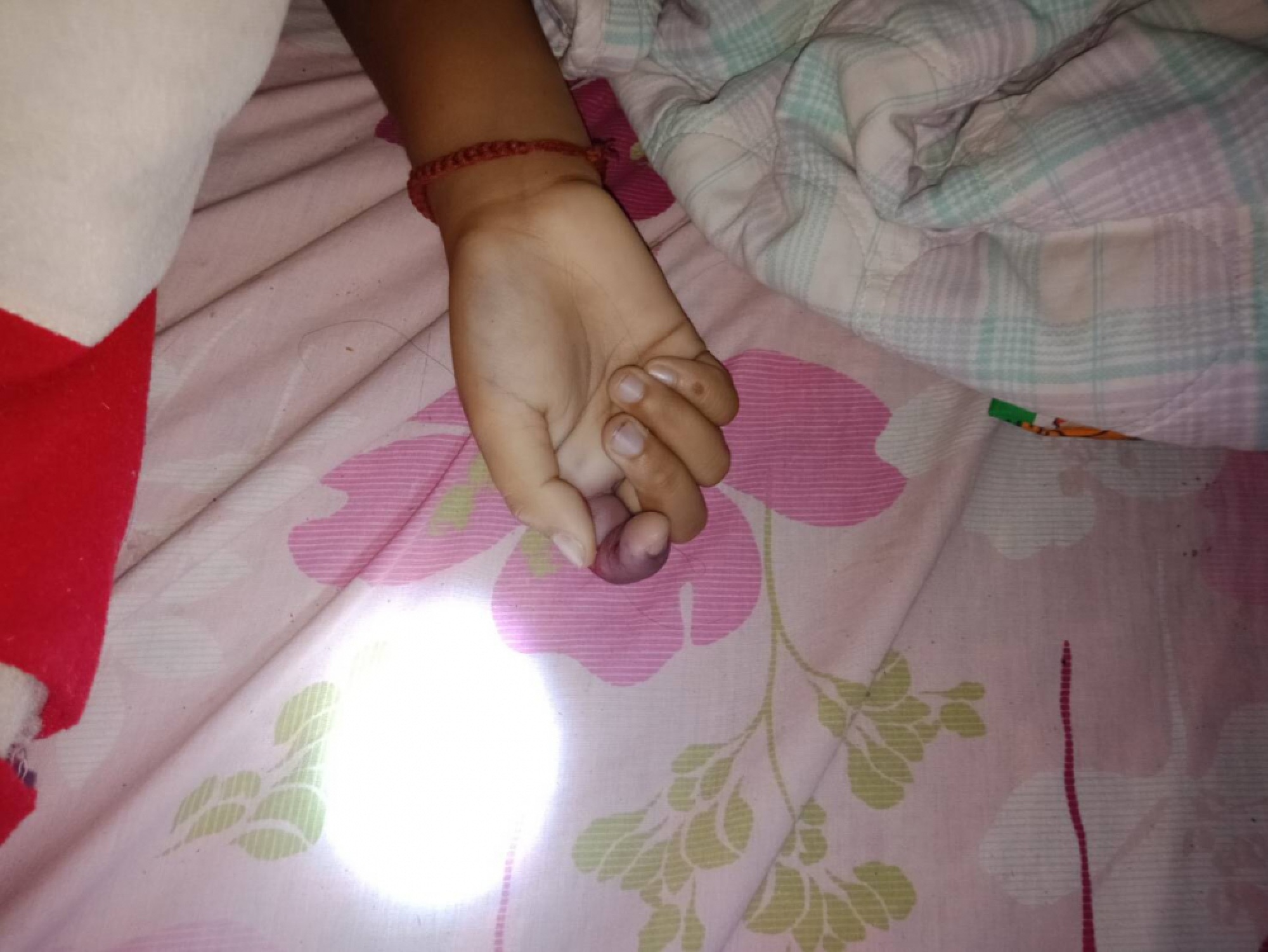 Girl, 9, fatally bitten by cobra