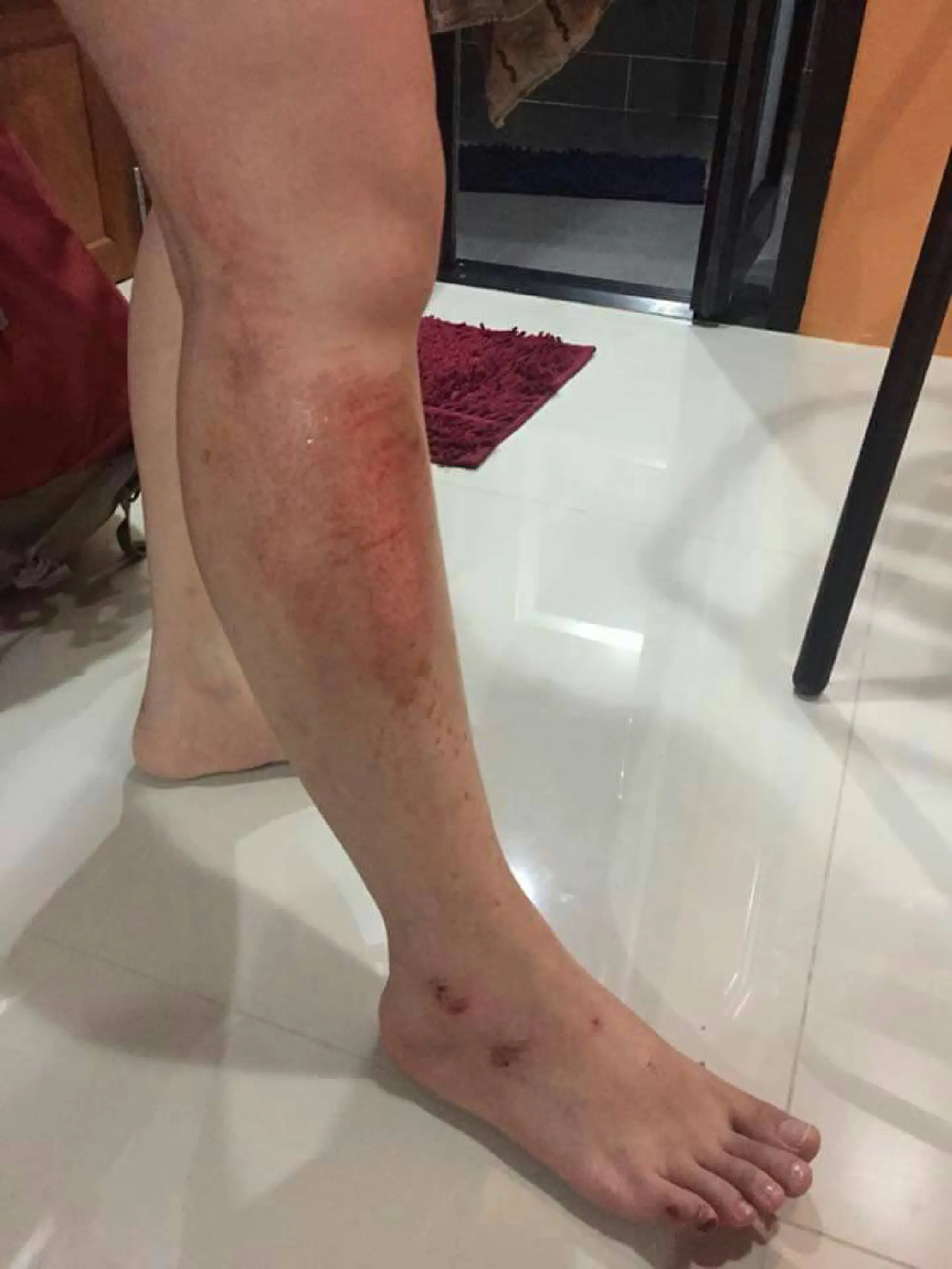 Chinese tourist assaulted in Krabi