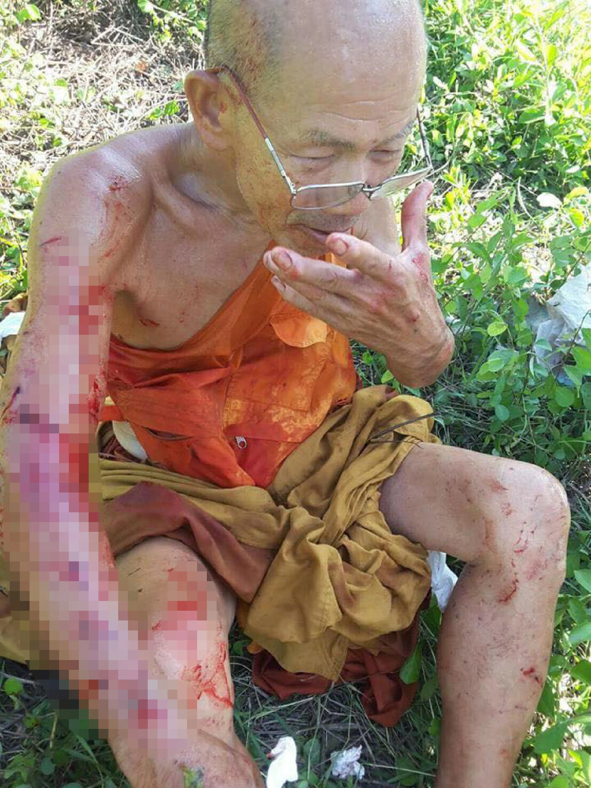 Monk survives pit bull onslaught