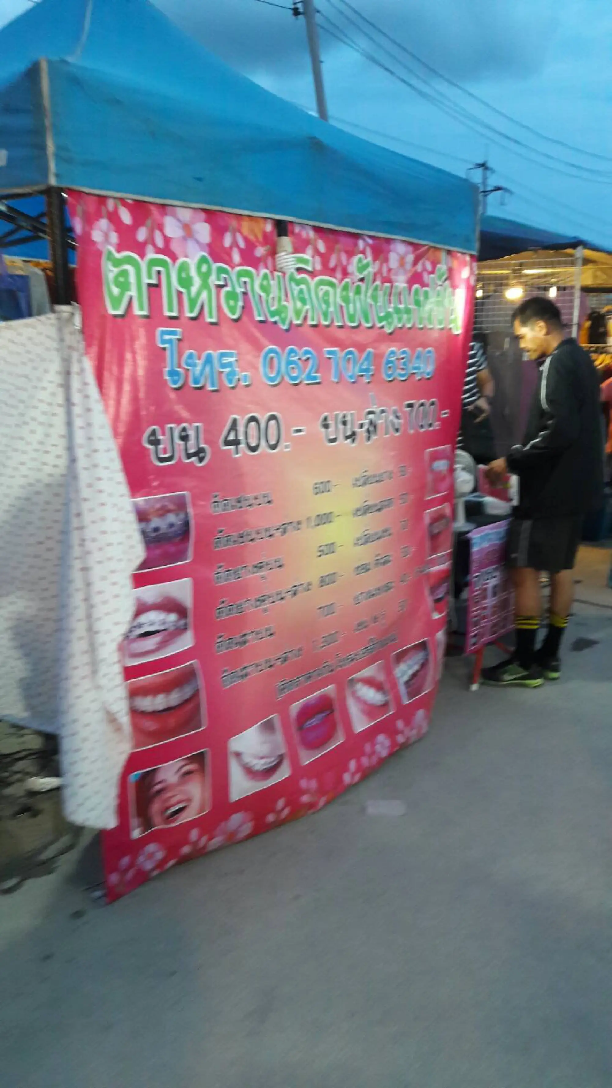 Man arrested for providing teeth brace service