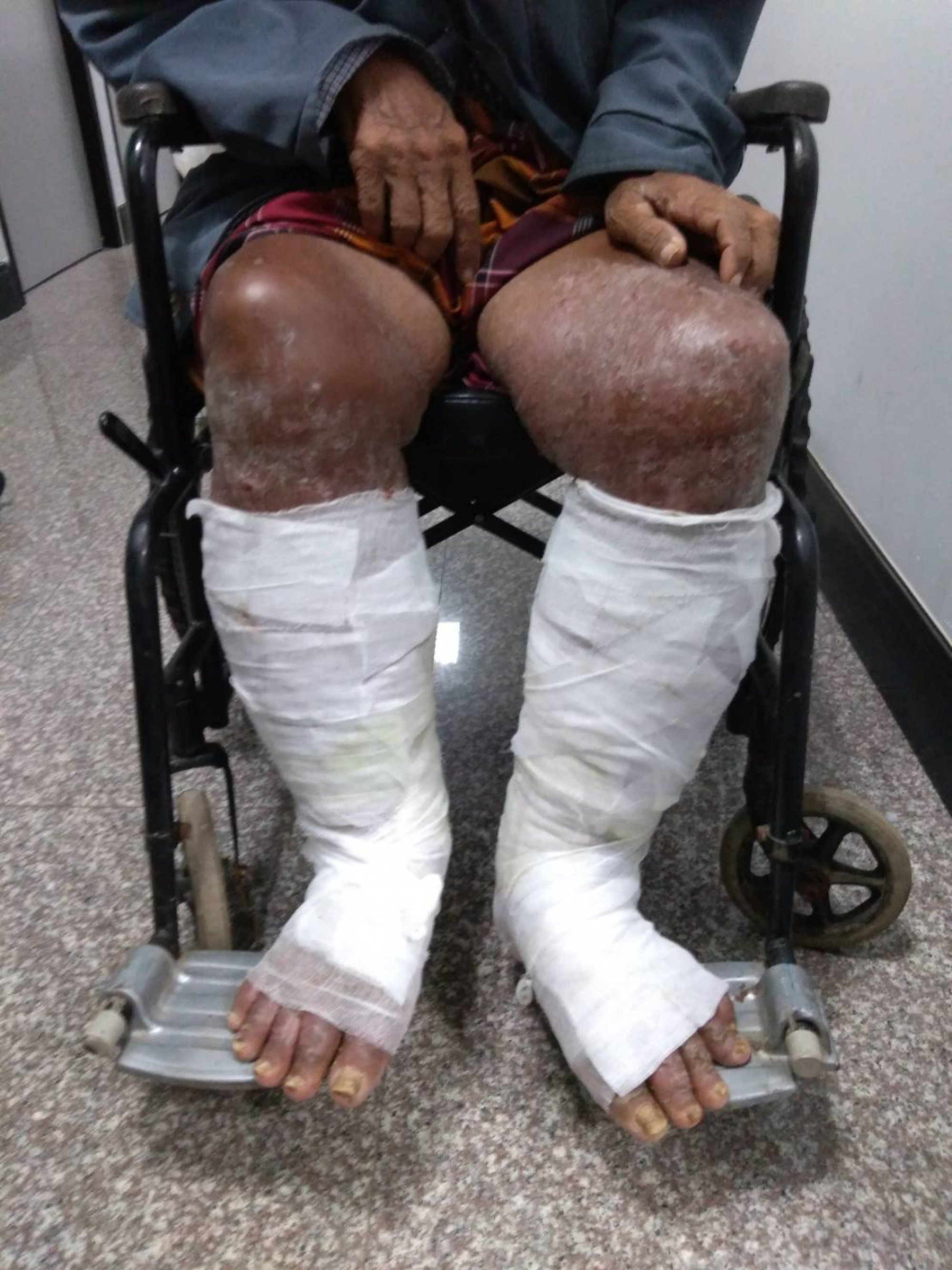 Blood tests conducted on farmers shows contamination with toxic farm chemicals