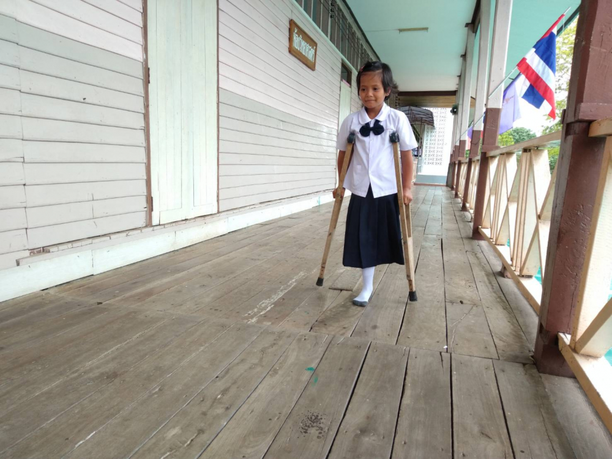 Poor mother begs for prosthetic leg for 9-year-old girl