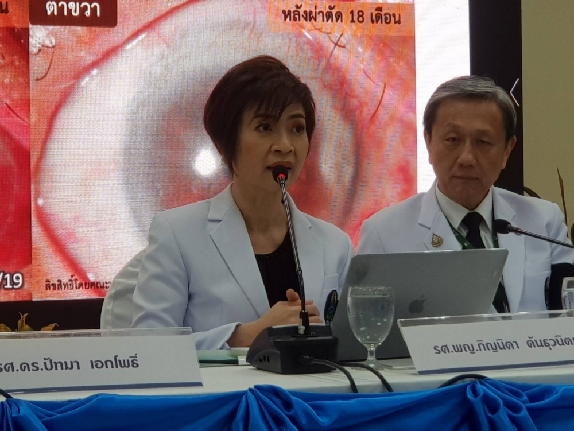 Siriraj successful in ground-breaking stemcell treatment