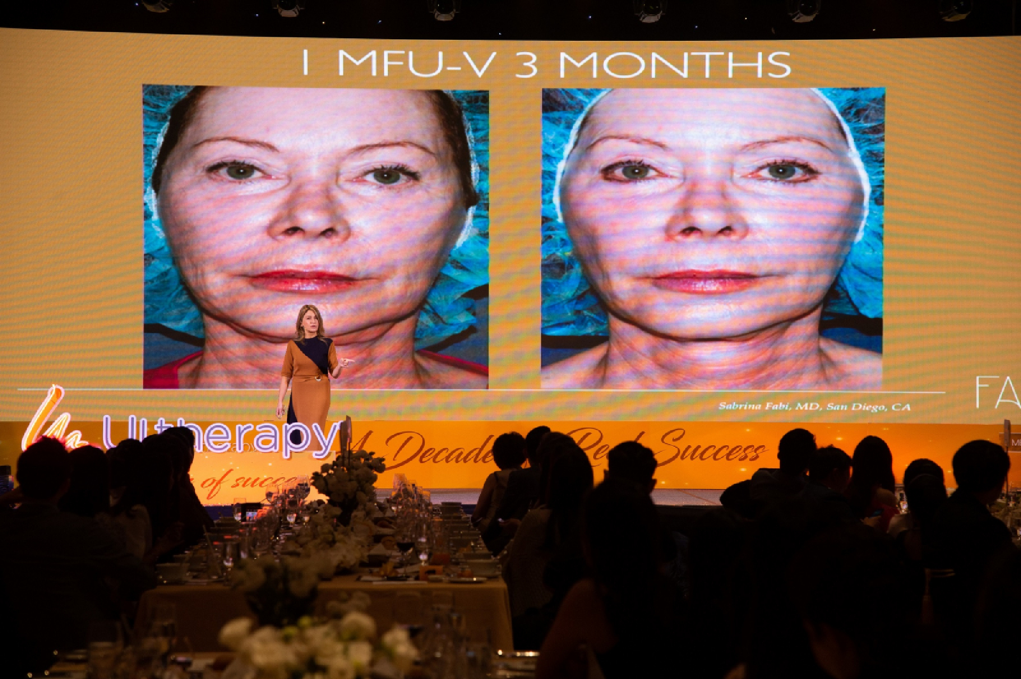 Nothing like a little lift