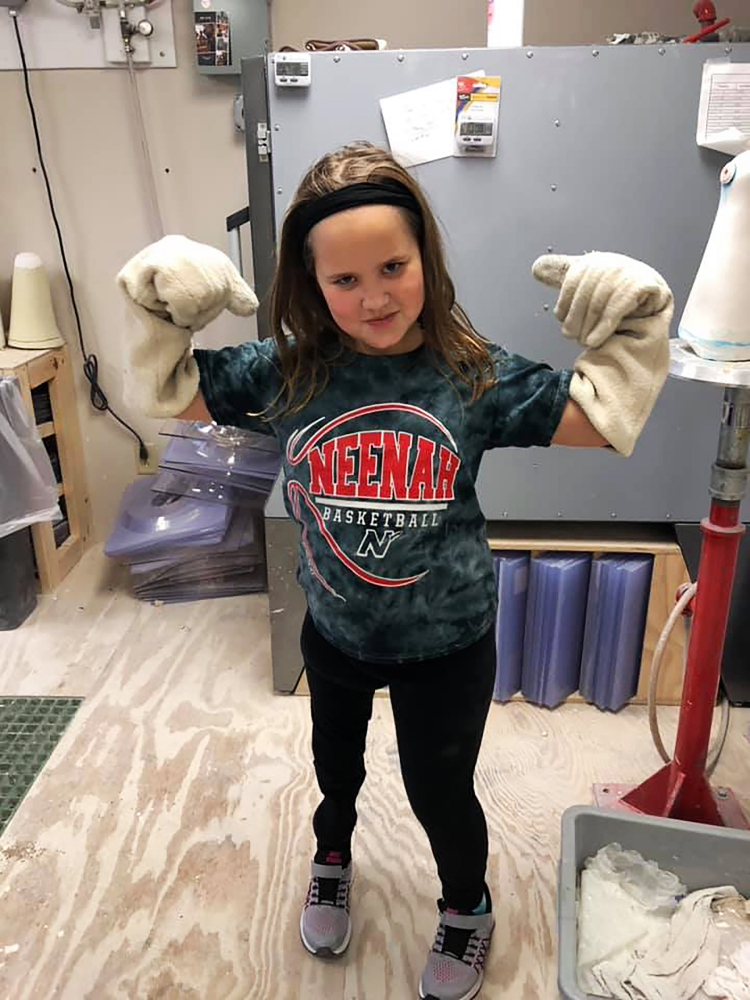 Faith Trznadel's leg was amputated when she was 10 months old. Faith, now 11, loves dancing and gymnastics, activities she is able to pursue because of her prosthetic, which allows running. MUST CREDIT: Sheila Trznadel